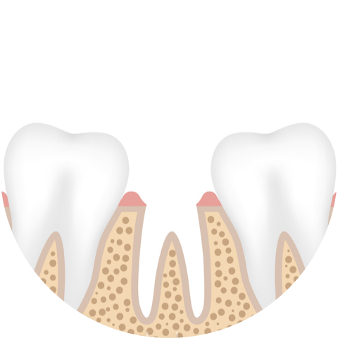 missing tooth image