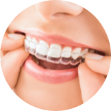 invisalign