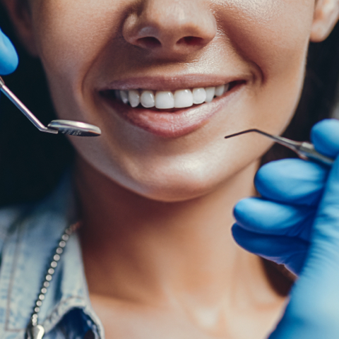 Woman's teeth being checked image