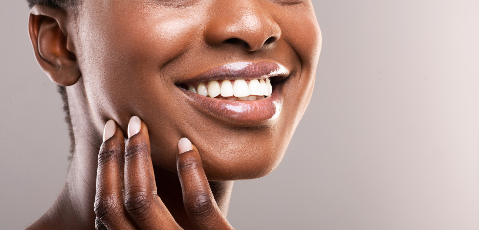 black lady holding hand to chin showing off pearly white smile with straight, whitened teeth