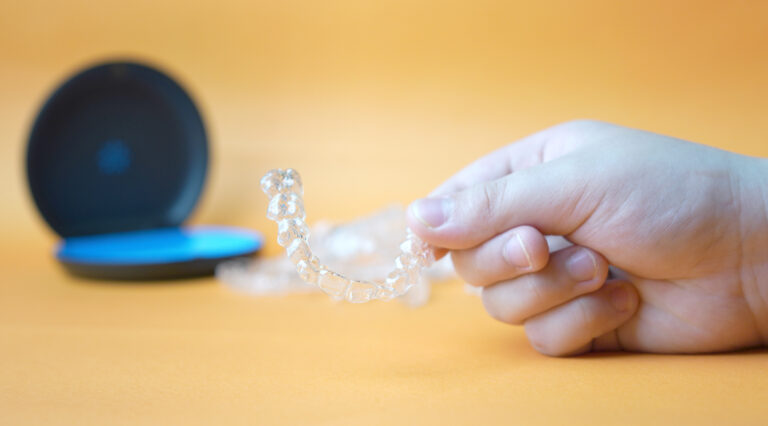 How much is Invisalign in the UK? All you need to know