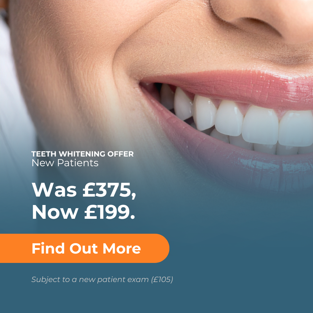 teeth whitening special offer